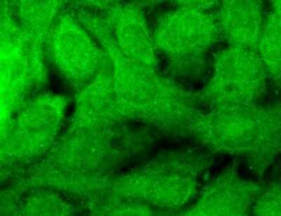 Immunocytochemistry/ Immunofluorescence: GABA-A R beta 1 Antibody (S96-55) [NBP1-48319]