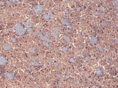 Immunohistochemistry: GABA-A R beta 3 Antibody (N87/25) [NBP1-47613]