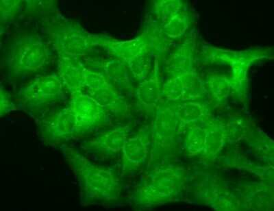 Immunocytochemistry/ Immunofluorescence: GABA-A R delta Antibody (N151/3) [NBP1-47616]