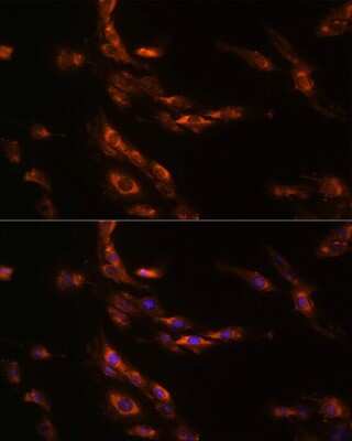 Immunocytochemistry/ Immunofluorescence: GABA-A R gamma 1 Antibody - Azide and BSA Free [NBP3-03553]