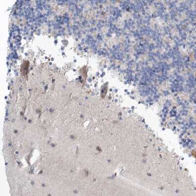 Immunohistochemistry-Paraffin: GABA-A R gamma 1 Antibody [NBP1-91003]