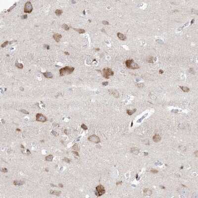 Immunohistochemistry-Paraffin: GABA-A R gamma 1 Antibody [NBP1-91003]