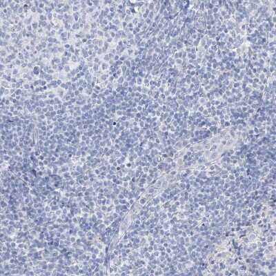 Immunohistochemistry-Paraffin: GABA-A R gamma 1 Antibody [NBP1-91003]