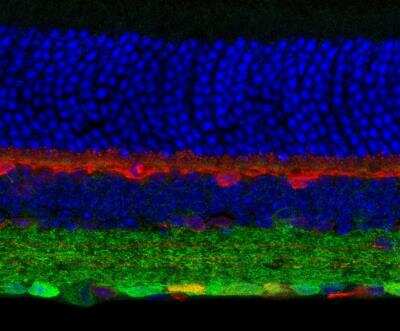 Immunohistochemistry: GABA-A R gamma 2 Antibody [NB300-190]