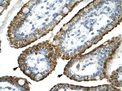 Immunohistochemistry: GABA-A R pi Antibody [NBP2-84036]