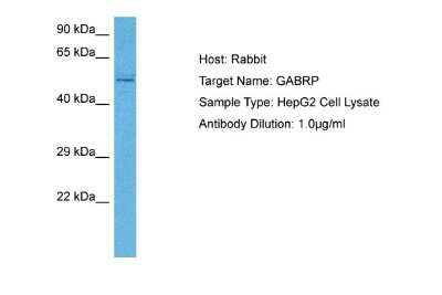 Western Blot: GABA-A R pi Antibody [NBP2-84036]