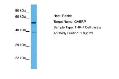 Western Blot: GABA-A R pi Antibody [NBP2-84036]