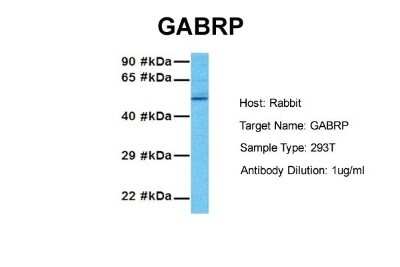 Western Blot: GABA-A R pi Antibody [NBP2-84037]