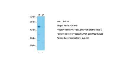 Western Blot: GABA-A R pi Antibody [NBP2-84037]
