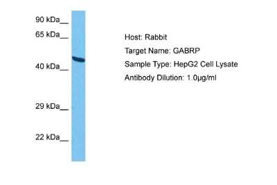 Western Blot: GABA-A R pi Antibody [NBP2-84037]