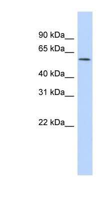 Western Blot: GABA-A R rho 1 Antibody [NBP1-79971]