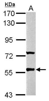 Western Blot: GABA-A R rho 2 Antibody [NBP2-16573]