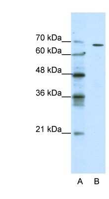 Western Blot: GABA-A R theta Antibody [NBP1-80078]