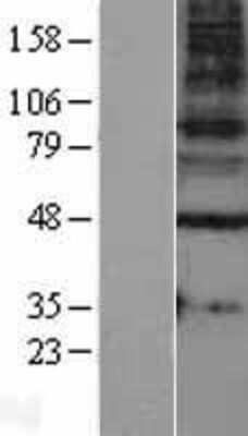 Western Blot: GABA-A R gamma 1 Overexpression Lysate [NBL1-10925]