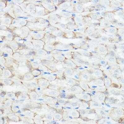 Immunohistochemistry-Paraffin: GABA-AR alpha 2 Antibody - BSA Free [NBP3-02985]
