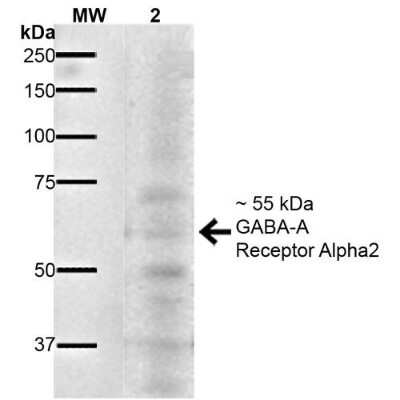 Western Blot: GABA-AR alpha 2 Antibody (S399-19) [NBP2-59325]