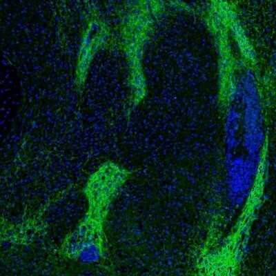 Immunohistochemistry: GABA-AR alpha 3 Antibody [NBP1-87499]