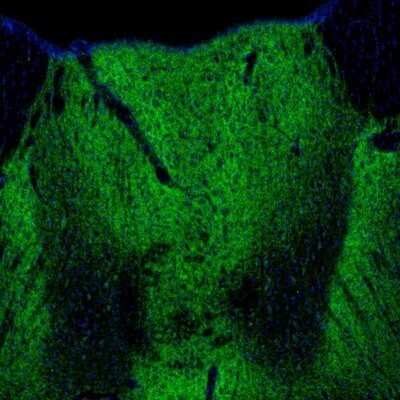Immunohistochemistry: GABA-AR alpha 3 Antibody [NBP1-87499]