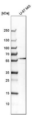Western Blot: GABA-AR alpha 3 Antibody [NBP1-87499]