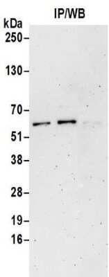 Immunoprecipitation: GABA-AR alpha 4 Antibody [NBP2-32077]