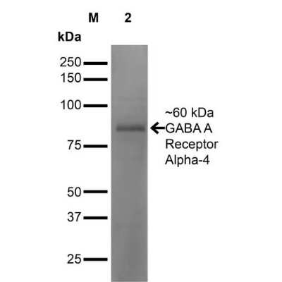 Western Blot: GABA-AR alpha 4 Antibody (S398A-34) [NBP2-59326]