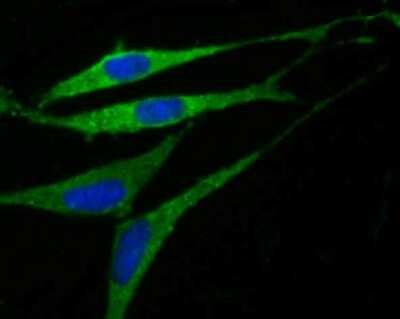 Immunocytochemistry/ Immunofluorescence: GABA-AR alpha 5 Antibody (JB34-19) [NBP2-75497]