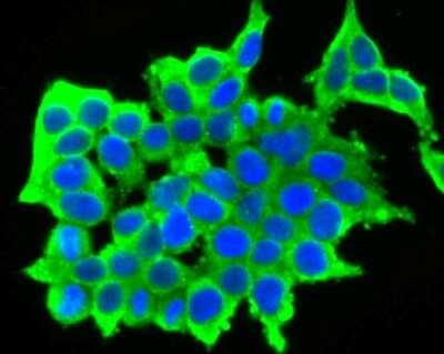 Immunocytochemistry/ Immunofluorescence: GABA-AR alpha 5 Antibody (JB34-19) [NBP2-75497]