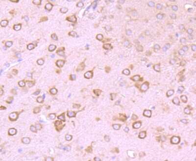 Immunohistochemistry-Paraffin: GABA-AR alpha 5 Antibody (JB34-19) [NBP2-75497]