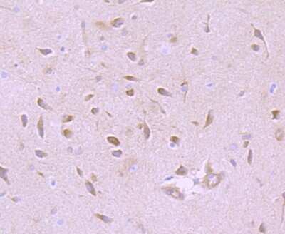 Immunohistochemistry-Paraffin: GABA-AR alpha 5 Antibody (JB34-19) [NBP2-75497]
