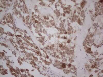 Immunohistochemistry: GABA-AR alpha 5 Antibody (OTI1G9) - Azide and BSA Free [NBP2-70789]