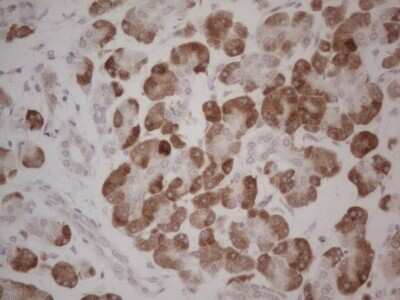 Immunohistochemistry: GABA-AR alpha 5 Antibody (OTI1G9) - Azide and BSA Free [NBP2-70789]