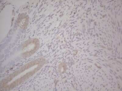 Immunohistochemistry: GABA-AR alpha 5 Antibody (OTI1G9) - Azide and BSA Free [NBP2-70789]