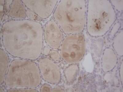 Immunohistochemistry: GABA-AR alpha 5 Antibody (OTI1G9) - Azide and BSA Free [NBP2-70789]