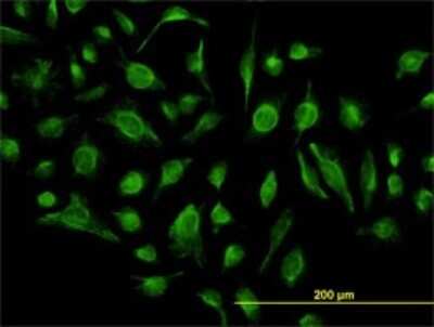 Immunocytochemistry/ Immunofluorescence: GABA-B R1 Antibody (2D7) [H00002550-M01]