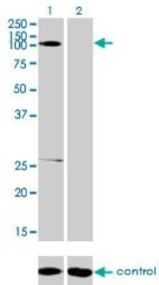 Western Blot: GABA-B R1 Antibody (2D7) [H00002550-M01]