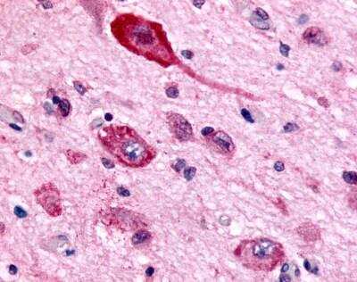 Immunohistochemistry-Paraffin: GABA-B R1 Antibody - BSA Free [NLS5332]