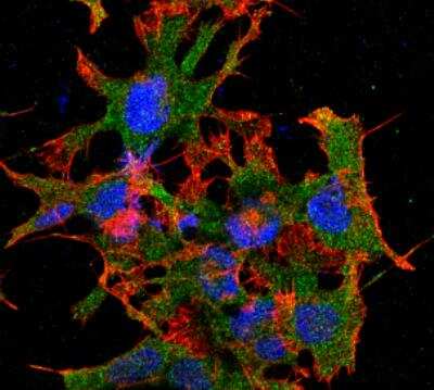 Immunocytochemistry/ Immunofluorescence: GABA-B R1 Antibody (S93A-49) [NBP2-59336]