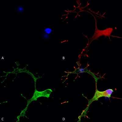 Immunocytochemistry/ Immunofluorescence: GABA-B R1 Antibody (S93A-49) [NBP2-59336]