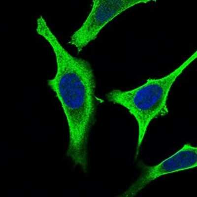 Immunocytochemistry/ Immunofluorescence: GABA-B R2 Antibody (5G7F7) - BSA Free [NBP2-37281]