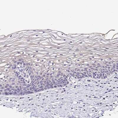 Immunohistochemistry-Paraffin: GABA-B R2 Antibody [NBP1-89803]
