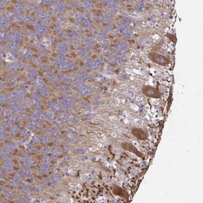 Immunohistochemistry-Paraffin: GABA-B R2 Antibody [NBP2-48516]