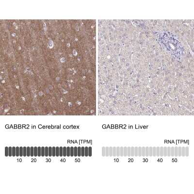 Immunohistochemistry-Paraffin: GABA-B R2 Antibody [NBP2-48516]