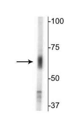 Western Blot: GABA Transporter 2 Antibody [NB100-61098]