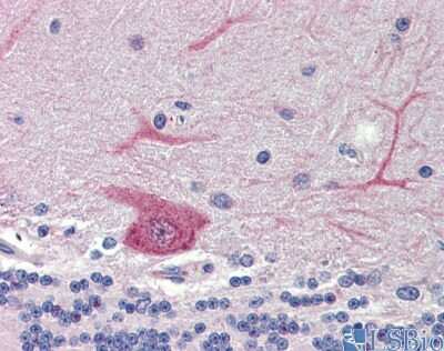 Immunohistochemistry: GABARAPL1 Antibody [NBP1-55203]