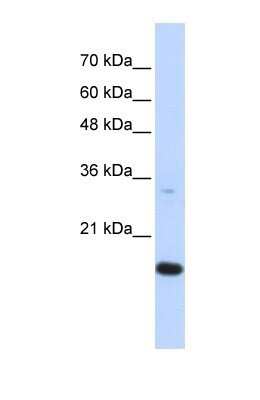Western Blot: GABARAPL1 Antibody [NBP1-55202]