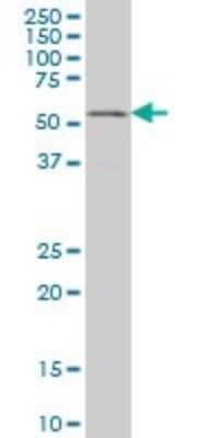Western Blot: GABPA Antibody (5B6) [H00002551-M06]