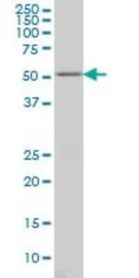 Western Blot: GABPA Antibody (M1) [H00002551-M03]