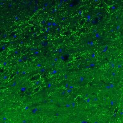 Immunohistochemistry: GAD1/GAD67 Antibody (CL2911) [NBP2-46637]
