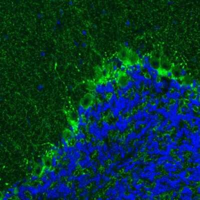 Immunohistochemistry: GAD1/GAD67 Antibody (CL2911) [NBP2-46637]