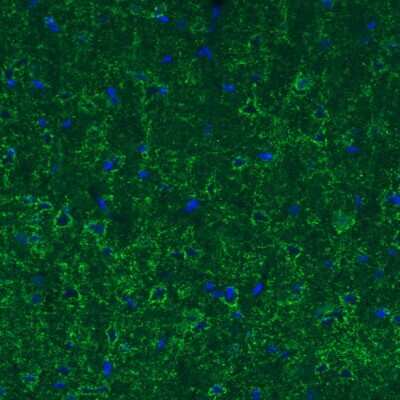 Immunohistochemistry: GAD1/GAD67 Antibody (CL2914) [NBP2-46638]